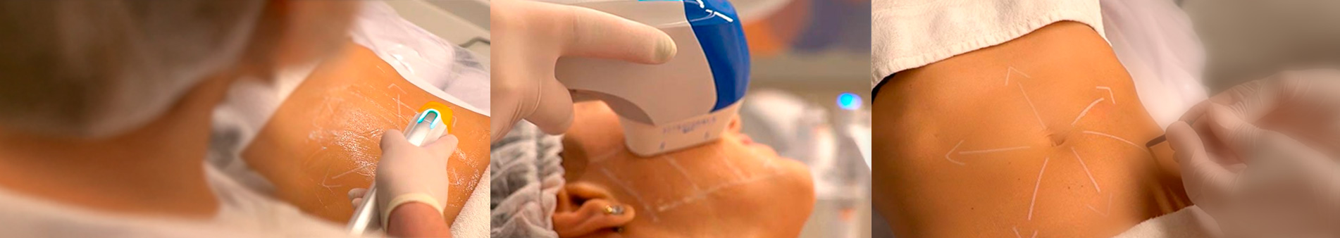 Banner-ultraformer-mpt